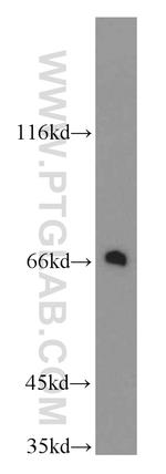 TGFBI / BIGH3 Antibody in Western Blot (WB)