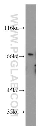 TGFBI / BIGH3 Antibody in Western Blot (WB)