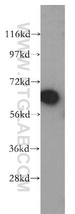 TGFBI / BIGH3 Antibody in Western Blot (WB)