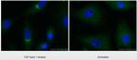 TGFBI / BIGH3 Antibody in Immunocytochemistry (ICC/IF)