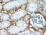 TGFBI / BIGH3 Antibody in Immunohistochemistry (Paraffin) (IHC (P))