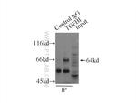 TGFBI / BIGH3 Antibody in Immunoprecipitation (IP)