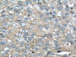 IGFBP3 Antibody in Immunohistochemistry (Paraffin) (IHC (P))