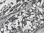 IGFBP3 Antibody in Immunohistochemistry (Paraffin) (IHC (P))