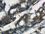 IGFBP3 Antibody in Immunohistochemistry (Paraffin) (IHC (P))