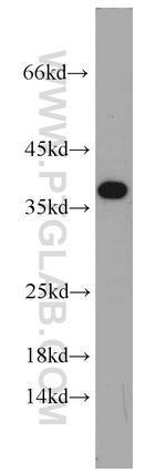 IGFBP3 Antibody in Western Blot (WB)