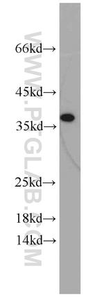 IGFBP3 Antibody in Western Blot (WB)