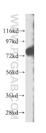 ECD Antibody in Western Blot (WB)