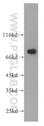 ECD Antibody in Western Blot (WB)