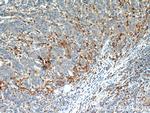 CAPG Antibody in Immunohistochemistry (Paraffin) (IHC (P))