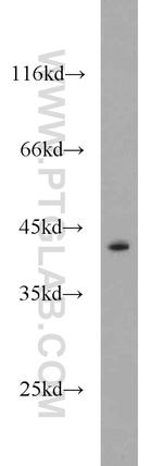 CAPG Antibody in Western Blot (WB)