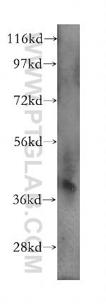 CAPG Antibody in Western Blot (WB)