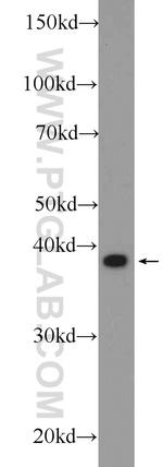 CAPG Antibody in Western Blot (WB)