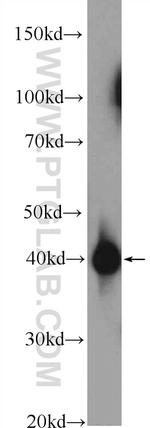 CAPG Antibody in Western Blot (WB)