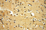 RUVBL2 Antibody in Immunohistochemistry (Paraffin) (IHC (P))