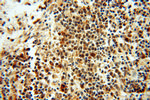 RUVBL2 Antibody in Immunohistochemistry (Paraffin) (IHC (P))