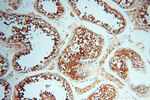 RUVBL2 Antibody in Immunohistochemistry (Paraffin) (IHC (P))