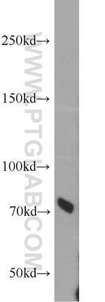 RBM14 Antibody in Western Blot (WB)