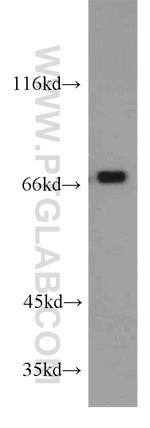 RBM14 Antibody in Western Blot (WB)