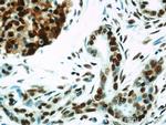 HDAC1 Antibody in Immunohistochemistry (Paraffin) (IHC (P))