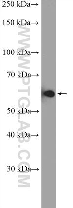 HDAC1 Antibody in Western Blot (WB)