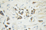 Caspase 6/p18/p11 Antibody in Immunohistochemistry (Paraffin) (IHC (P))