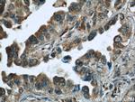 Caspase 6/p18/p11 Antibody in Immunohistochemistry (Paraffin) (IHC (P))