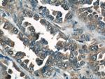 Caspase 6/p18/p11 Antibody in Immunohistochemistry (Paraffin) (IHC (P))