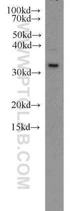 Caspase 6/p18/p11 Antibody in Western Blot (WB)