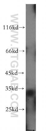 Caspase 6/p18/p11 Antibody in Western Blot (WB)