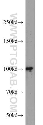 DDX23 Antibody in Western Blot (WB)