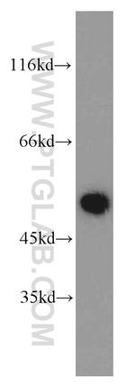 WTAP Antibody in Western Blot (WB)