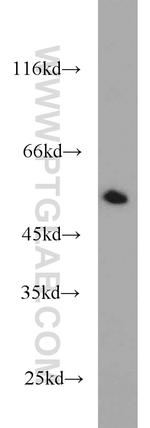 WTAP Antibody in Western Blot (WB)