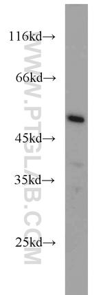 WTAP Antibody in Western Blot (WB)