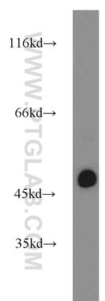 WTAP Antibody in Western Blot (WB)