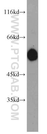 WTAP Antibody in Western Blot (WB)