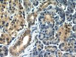 Ubiquitin Antibody in Immunohistochemistry (Paraffin) (IHC (P))