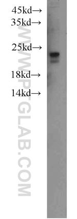 Ubiquitin Antibody in Western Blot (WB)