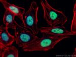 PCNA Antibody in Immunocytochemistry (ICC/IF)