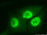 PCNA Antibody in Immunocytochemistry (ICC/IF)