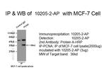 PCNA Antibody in Immunoprecipitation (IP)