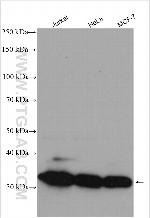 PCNA Antibody in Western Blot (WB)