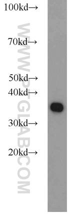 PCNA Antibody in Western Blot (WB)