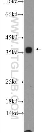 PCNA Antibody in Western Blot (WB)