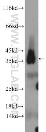 PCNA Antibody in Western Blot (WB)