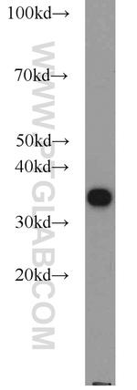 PCNA Antibody in Western Blot (WB)