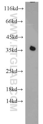 PCNA Antibody in Western Blot (WB)