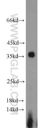 PCNA Antibody in Western Blot (WB)