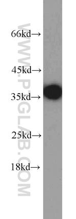 PCNA Antibody in Western Blot (WB)