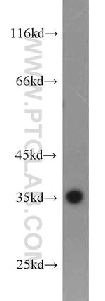 PCNA Antibody in Western Blot (WB)